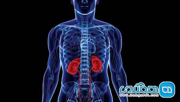 چگونه از شر کلیه درد خلاص شویم؟ چگونه از شر کلیه درد خلاص شویم؟